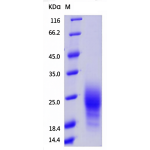 Mouse TIGIT / VSTM3 Protein (ECD, His Tag)