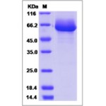 Mouse Alkaline Phosphatase / ALPL Protein (His Tag)
