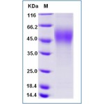 Mouse CD30 / TNFRSF8 Protein (His Tag)