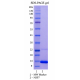 Recombinant SARS-CoV-2 NSP7 