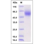 Rat CD111 / Nectin-1 / PVRL1 Protein (His Tag)
