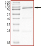 AKT1 (E17K), Unactive