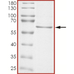 AKT1 (E17K), Unactive