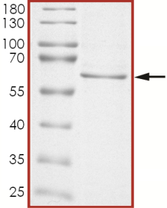 AKT1 (E17K), Unactive