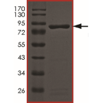 AKT2 (R274H), Active