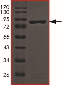 AKT2 (R274H), Active