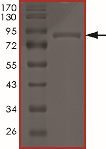 AKT3 (G171R), Active