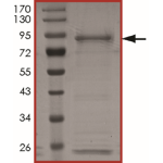 ALK (T1151M), Active