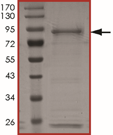 ALK (T1151M), Active