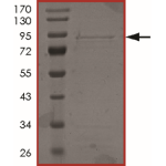 ALK (L1152R), Active