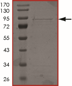 ALK (L1152R), Active