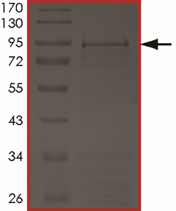 ALK (C1156Y), Active