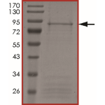 ALK (F1174L), Active