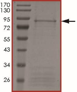 ALK (F1174L), Active