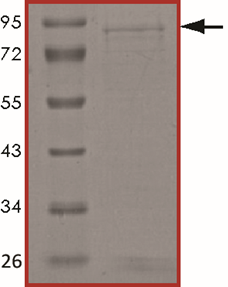 ALK (F1174S), Active