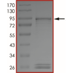 ALK (L1196M), Active