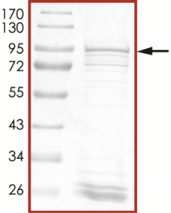 ALK (T1151_L1152insT), Active