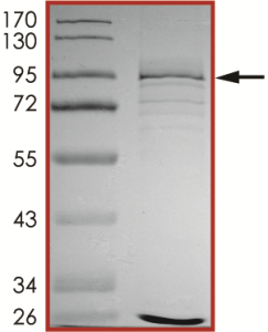 ALK (G1202R), Active