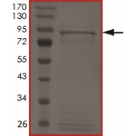 ALK (S1206R), Active