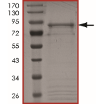 ALK (G1269A), Active