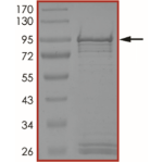 ALK (G1269S), Active
