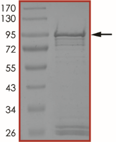 ALK (G1269S), Active