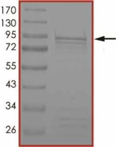 ALK (R1275Q), Active