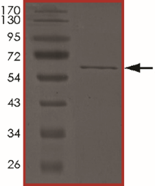 ALK6 (BMPR1B), Active
