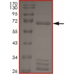 BRAF (V600K), Active