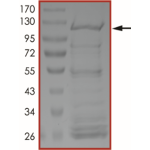 KIAA1549-BRAF (Kex16Bex9), Active