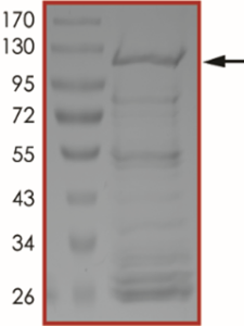 KIAA1549-BRAF (Kex16Bex9), Active