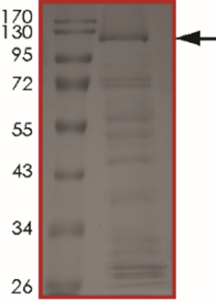 KIAA1549-BRAF (Kex15Bex9), Active