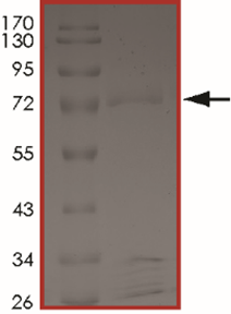 FAM131B-BRAF (Fex2Bex9), Active