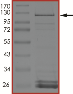SRGAP3-BRAF (Sex12Bex9), Active