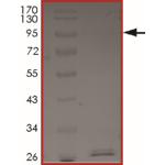 RNF130-BRAF (Rex3Bex9), Active