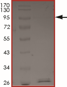 RNF130-BRAF (Rex3Bex9), Active
