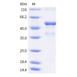 Recombinant Human CD137L