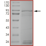 EGFR (P772_H773insNP) Protein