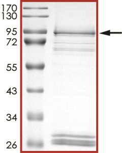 EGFR (d746-750), Active