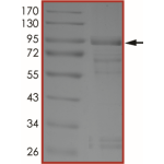 EGFR (R999A), Active