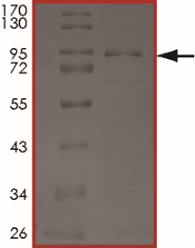 EGFR (G719D), Active