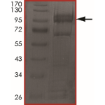 EGFR (d752-759), Active