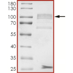 EGFR (D761Y), Active