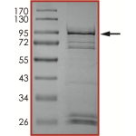 EGFR (A767-S768insTLA), Active
