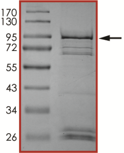 EGFR (A767-S768insTLA), Active
