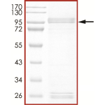 EGFR (D770_N771insG), Active