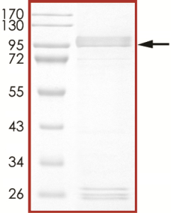 EGFR (D770_N771insG), Active