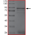EGFR (V769_D770insASV) Protein
