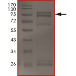 EGFR (V769_D770insGE) Protein