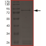 EGFR (D770_N771insGF) Protein